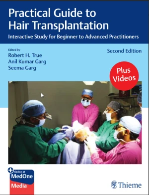Practical Guide to Hair Transplantation
